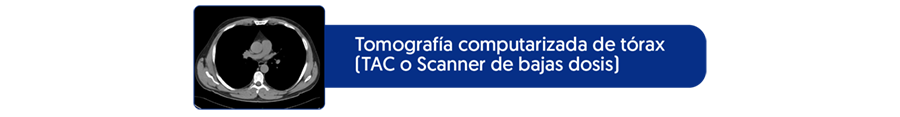 Tomografía computarizada
