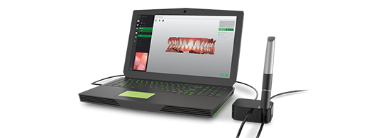Escáner Intraoral