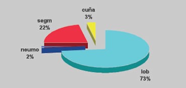Gráfico porcentual de Cirugía