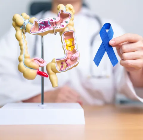 Médico con maqueta de colon, sosteniendo cinta azul en su mano