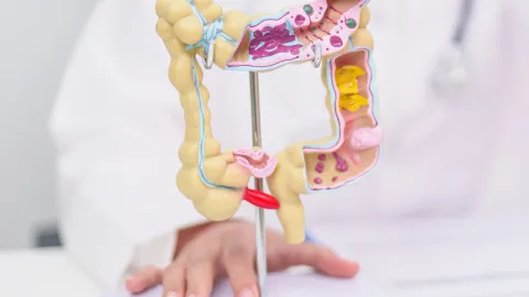 Detección precoz cáncer colorrectal