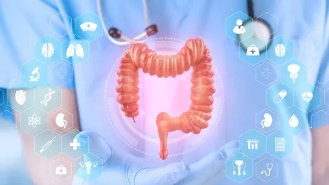 Tipos de cáncer colorrectal