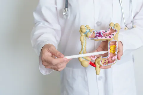 cáncer colon