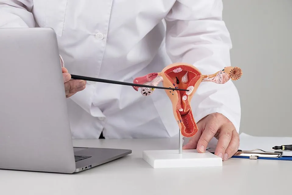 Endometriosis y los beneficios de la cirugía laparoscópica