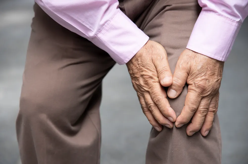 ¿Cómo reducir el riesgo de desarrollar osteoporosis?