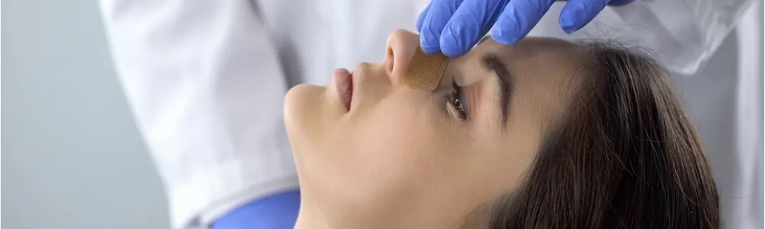 Rinoplastía: Una cirugía personalizada