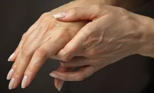 Aprendiendo a vivir con Artritis Reumatoide