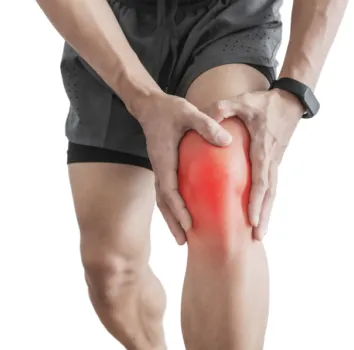 Rodilla