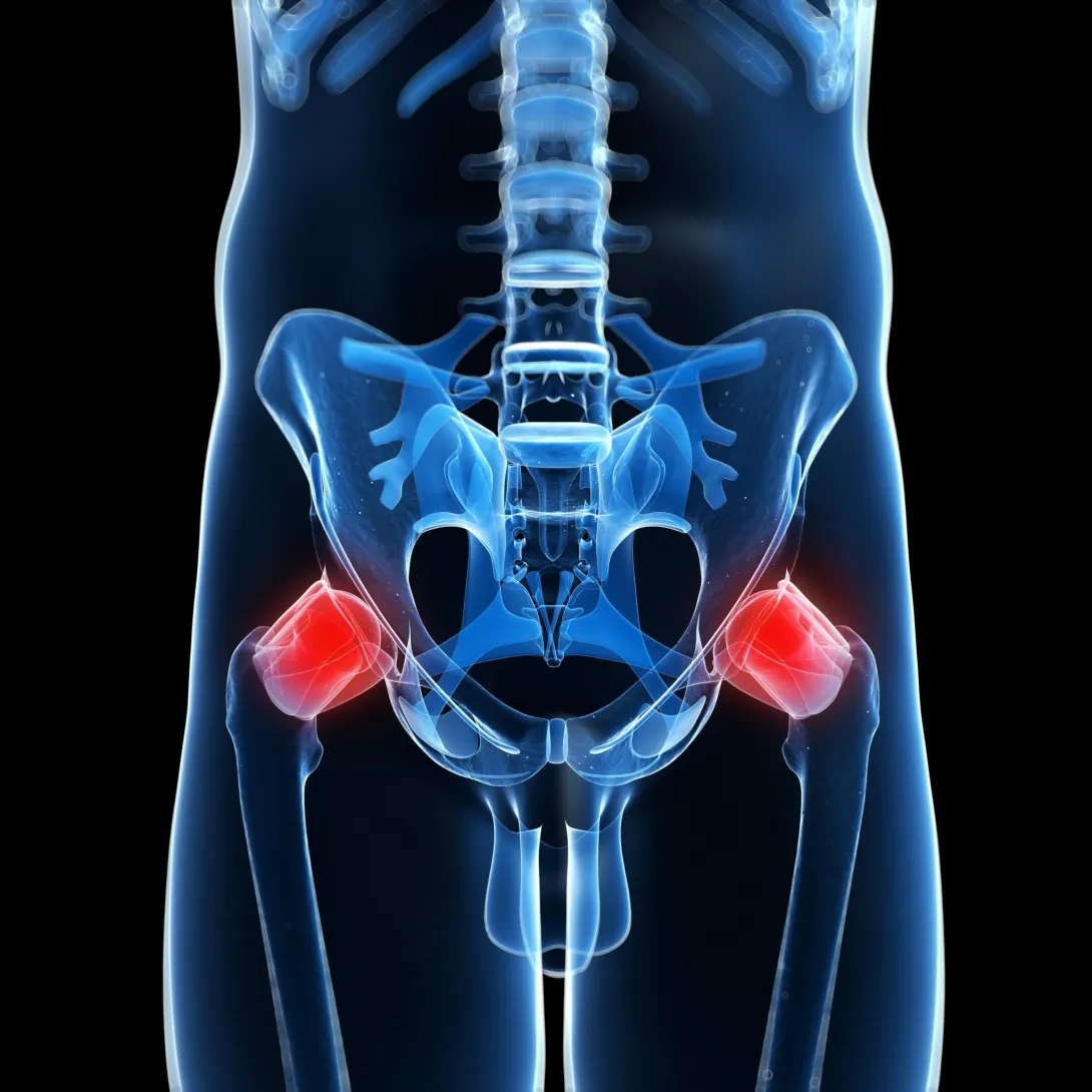 Cadera y Pelvis
