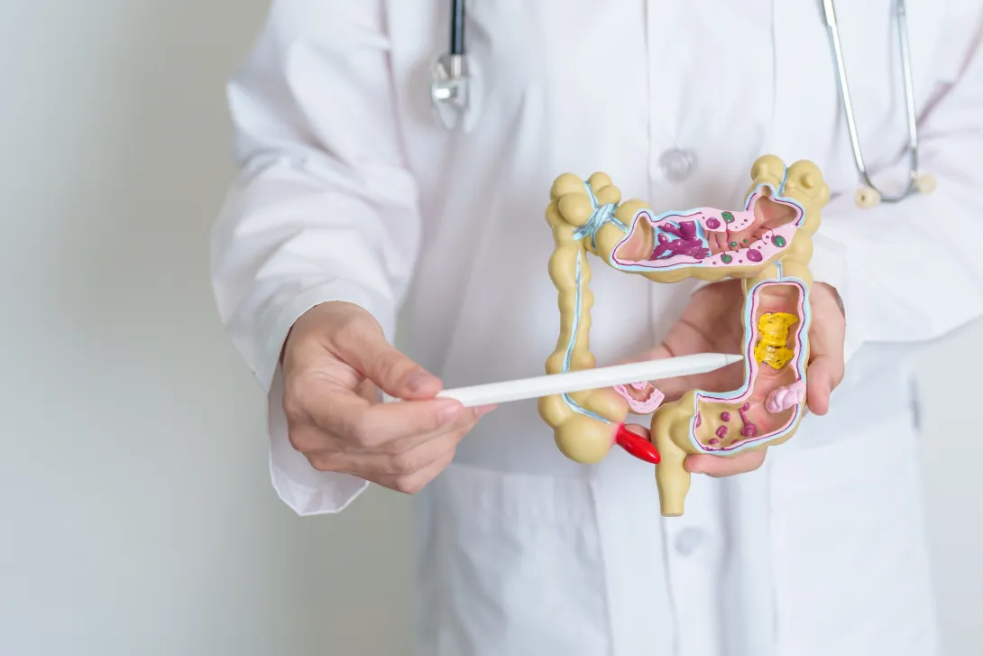 Los hábitos saludables son clave para prevenir el cáncer colorrectal