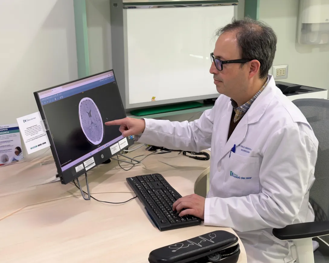 Día Mundial del Cerebro: Hasta el 90%   de algunos ACV podrían prevenirse