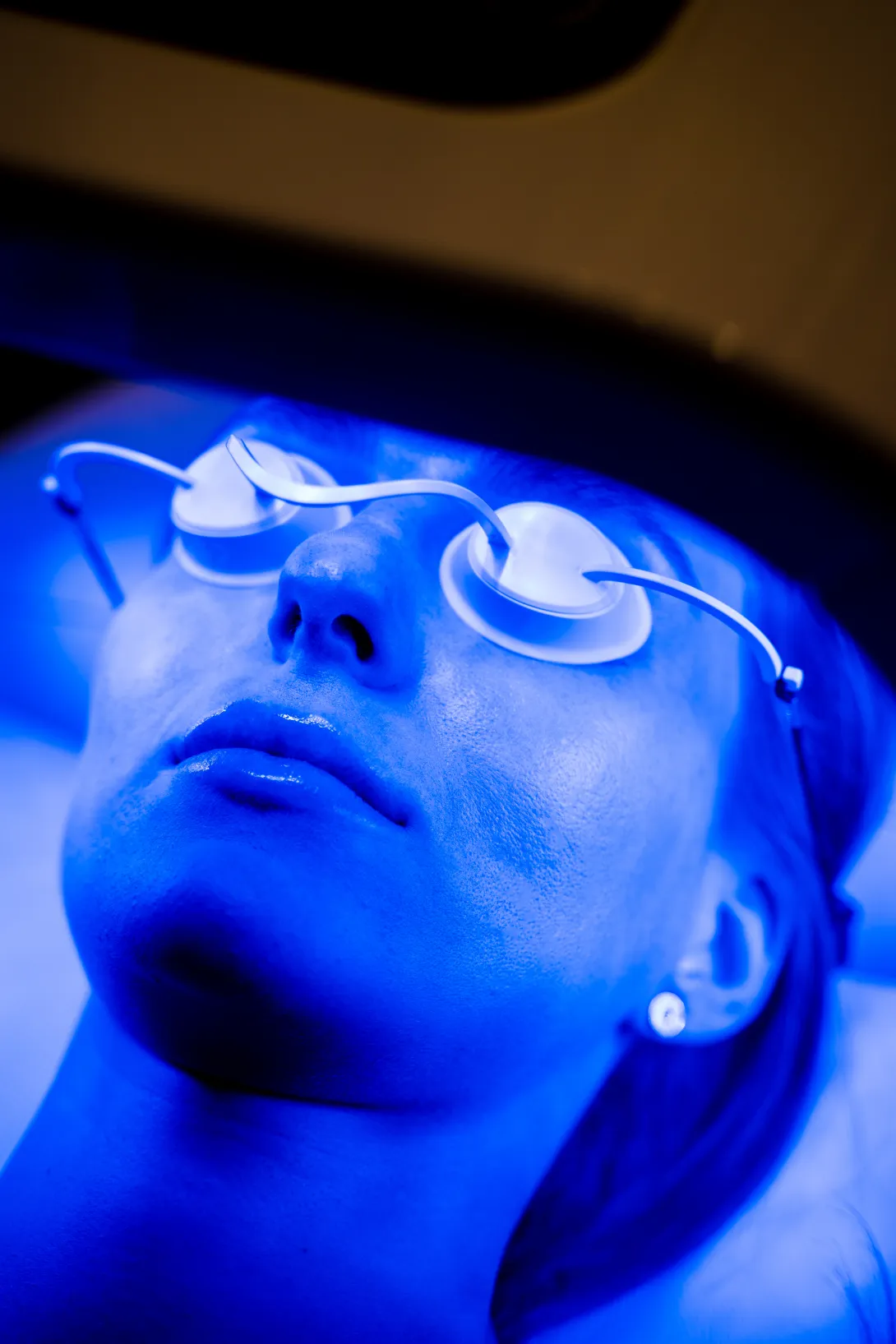 Clínica Dávila Recoleta incorpora nuevo servicio de Fototerapia Dermatológica